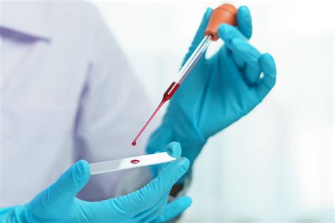 Complete Blood Count Test What Is Its Significance And Importance