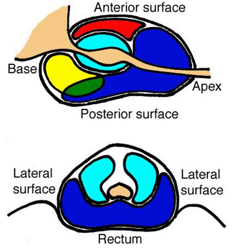 Anatomy Of The Prostate Gland Anatomical Zones Of The Prostate