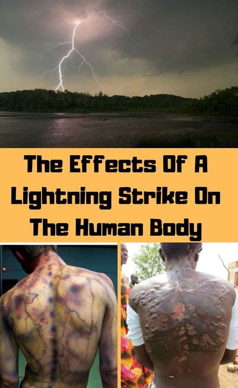 The Effects Of A Lightning Strike On The Human Body Fun Facts