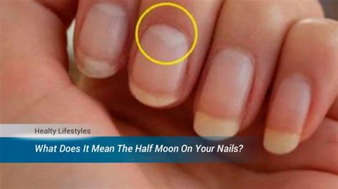 Do You Have White Spots Half Moonon Your Nails Heres What They Mean