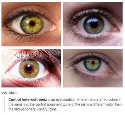 Eye Color Heterochromia Cool Stuff