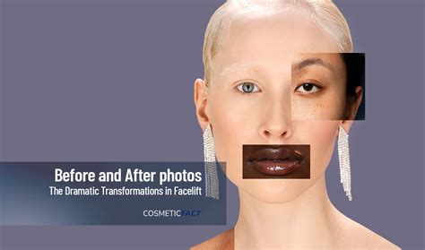 Aging to Youthful: The Incredible Transformations in Facelift Photos