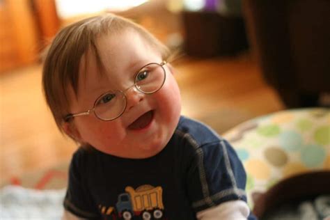 Life Worthy Of Life Down Syndrome Equality And My Son Silas Ave