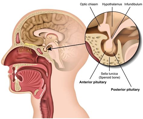 The Pituitary Dysfunction Structural Misalignment Connection