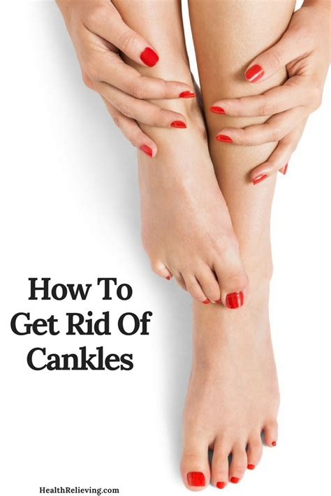 How To Get Rid Of Cankles 9 Steps With Instructions Healthrelieving
