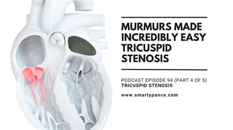 Podcast Episode 94 Murmurs Made Incredibly Easy Part 4 Of 5
