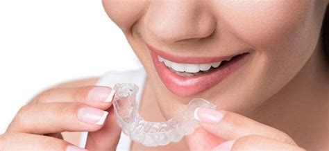 How much do braces cost without dental insurance? Top Reasons why you should have Invisible Braces to ...