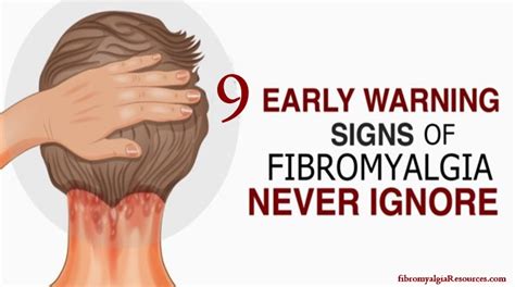 9 Early Signs Of Fibromyalgia Everyone Should Be Aware Of Fibromyalgia Resources