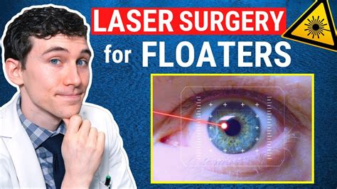 Eye Floater Laser Treatment Cost Roman Dunemann