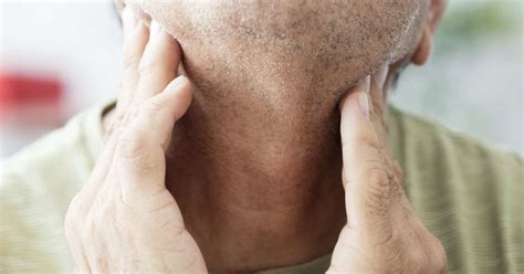 How Long Can Lymph Nodes Stay Swollen In Adults Preauricular Lymph
