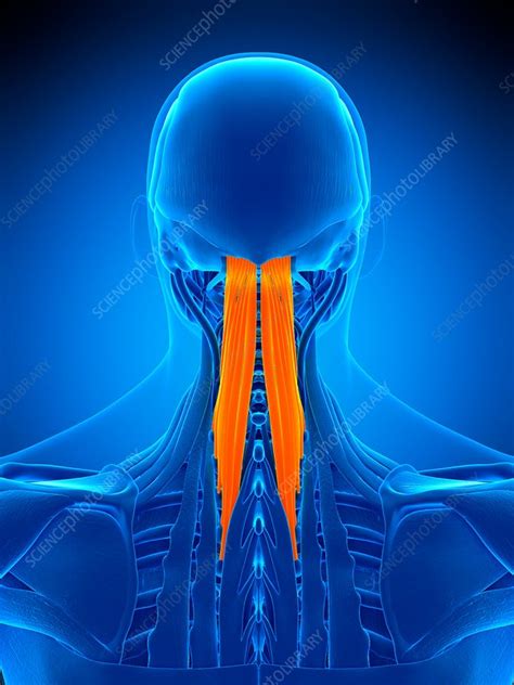 Neck Muscles Illustration Stock Image F0169413 Science Photo