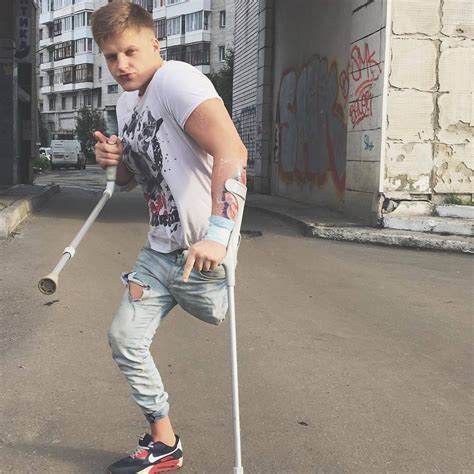 190 Male Leg Amputee Elbow Crutch Ideas In 2021 Amputee Crutches Legs