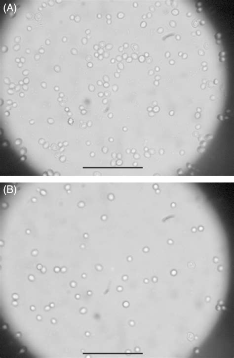 Microscopic Observation Of Yeast Cells Agglutinated By Cal Cal And