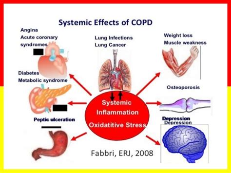Breathe Better Prevention Of Chronic Obstructive Pulmonary Disease