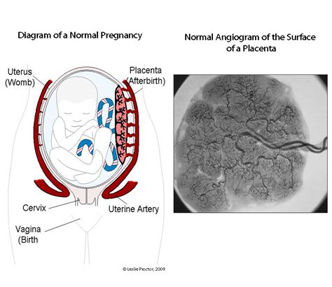 Normal Placenta Panel