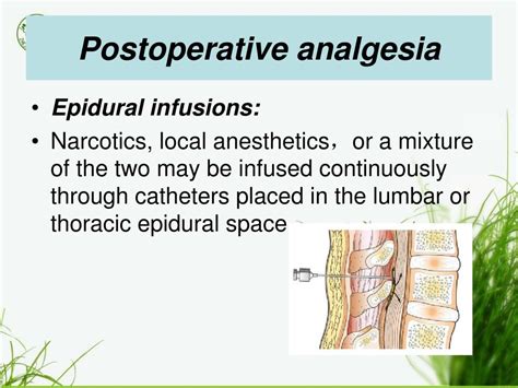 Ppt Management Of Acute Postoperative Pain Powerpoint Presentation