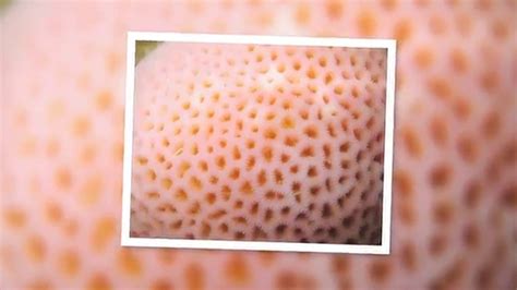 The Fear Of Small Holes Trypophobia Youtube