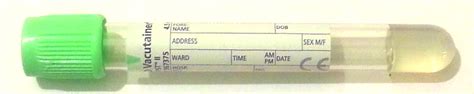 Bd Vacutainer Order Of Draw Chart Alter Playground