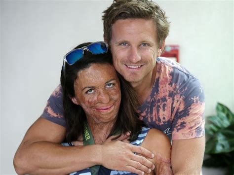 Turia Pitt Memoir Unmasked Body Soul