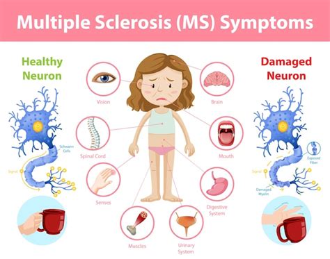 Free Vector Multiple Sclerosis Ms Symptoms Information Infographic