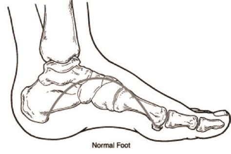 Dont Ignore Flat Feet Oakleaf Medical