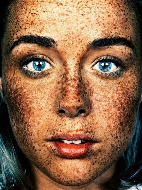 These Portraits Celebrate The Joy Of Having Freckles Photography Poses