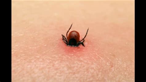 What A Tick Bite Looks Like On Humans