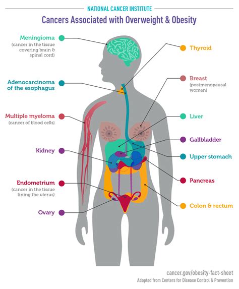 Cancers Associated With Overweight And Obesity Infographic Nci