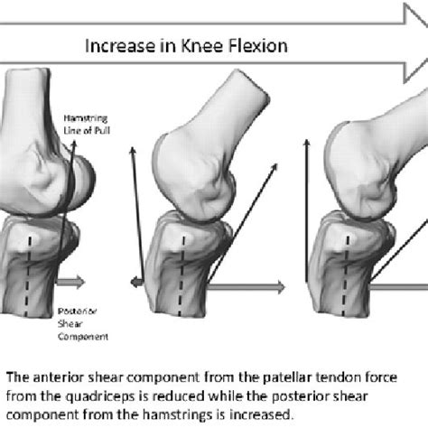 The Knee Flexion Angle Reduces The Patellar Tendon Angle Represented