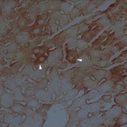 Light Photomicrographs Show The Immunohistochemical Expression Of PARP
