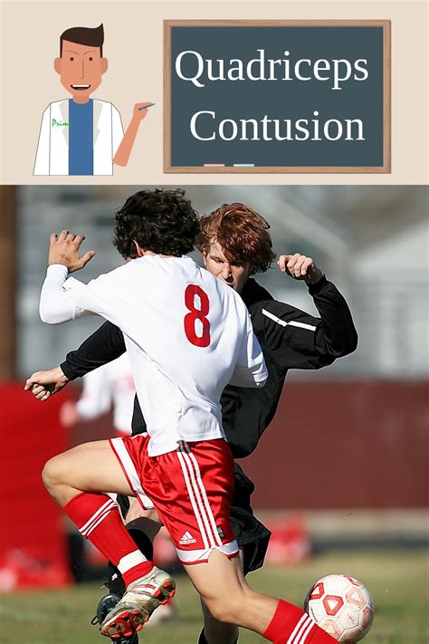 It connects the kneecap to the shinbone (tibia). Five common football injuries(4)-Quadriceps Contusion ...