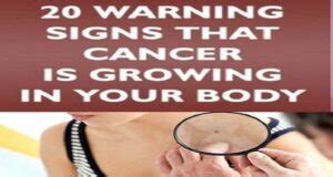 Warning Signs That Cancer Is Growing In Your Body Acu Doctor