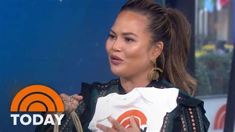 Chrissy Teigen Has Cheek Reduction Surgery To Fix Her Botched Face