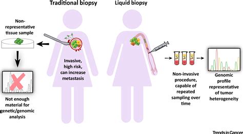 Improving Cancer Detection And Treatment With Liquid Biopsies And Ptdna