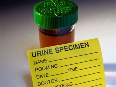 Why do i have bright yellow pee? What Does Your Urine Colour Indicate? - Indiatimes.com