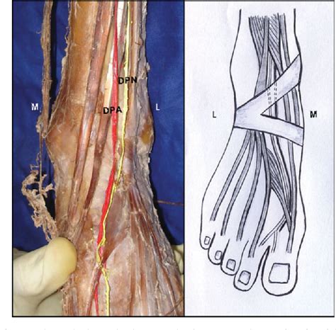 Relationship Between The Deep Peroneal Nerve And Dorsalis Pedis Artery
