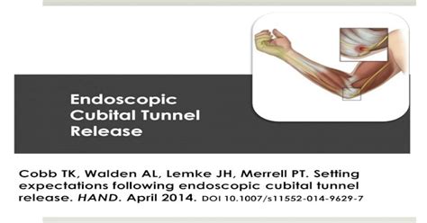 Endoscopic Cubital Tunnel Release · Cubital Tunnel Syndrome Studies