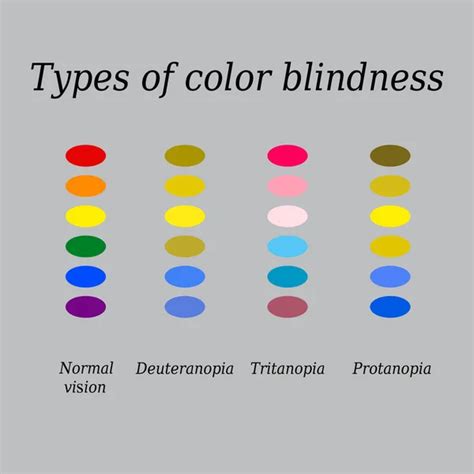 Types Of Color Blindness Eye Color Perception Vector Illustration On