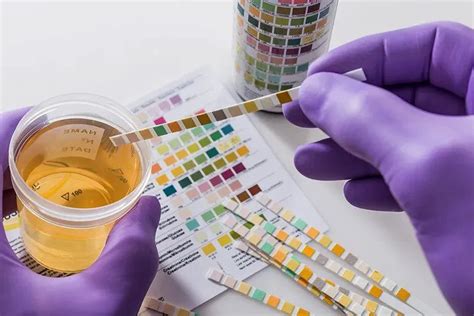 Urine Drug Test Guide Purpose Types Australia Drug Testing