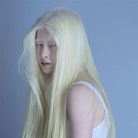Albino Girl Gets Abandoned As A Baby Grows Up To Become A Vogue Model Pics Delaram Art