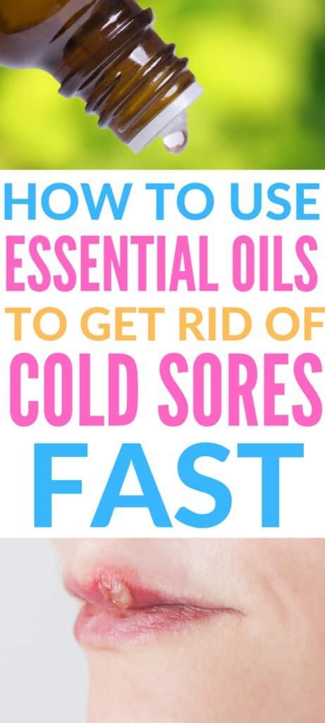 Essential Oils For Cold Sores Get Rid Of Cold Sores Quickly