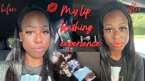 My Lip Blushing Experience Neutralization For Dark Lips Black Girl