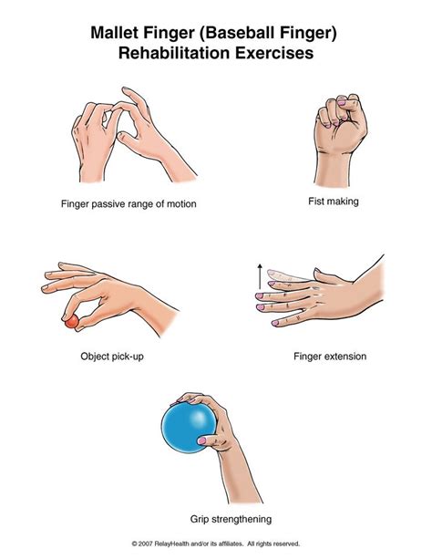 Summit Medical Group Mallet Finger Baseball Finger Exercises