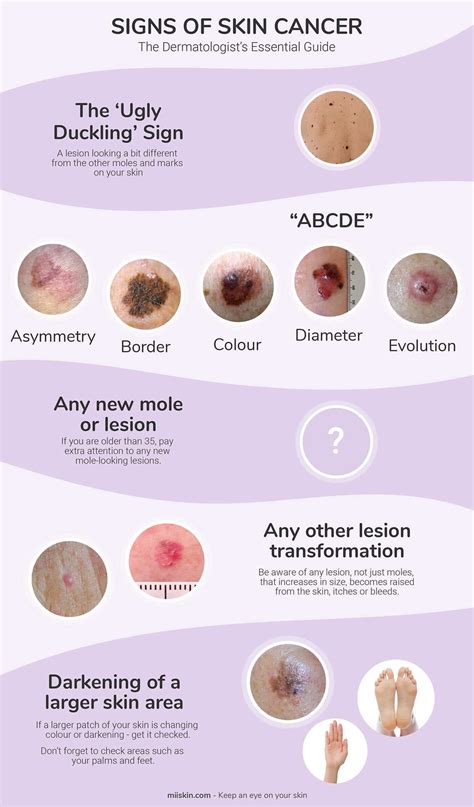 What Are Some Early Signs Of Skin Cancer