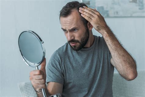 Alopecia is the medical term for excessive hair loss. 5 Hair Loss Solutions For Seniors - styleourlife.com
