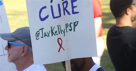 Estimates Of People Living With Hivaids In Riverside County Were