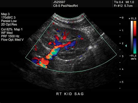 Kidney Ultrasound Scan Stock Photos Pictures And Royalty Free Images