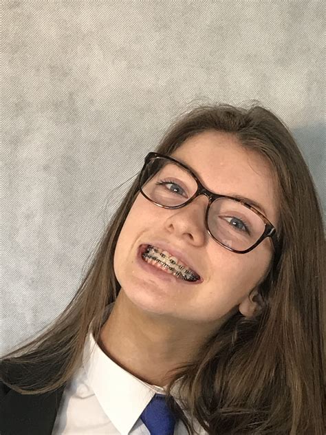 Braces Girls Cute Braces Braces And Glasses Girls With Glasses