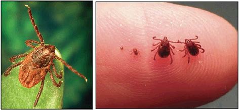 Despite the availability of effective treatment. New tick causes epidemic of Rocky Mountain spotted fever