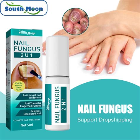 South Moon 5ml Nail Repair Liquid Effective Treatment Onychomycosis